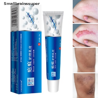 smallbrainssuper crema de eliminación de cicatrices de acné espinillas estrías gel cara eliminar acné suavizante sbs
