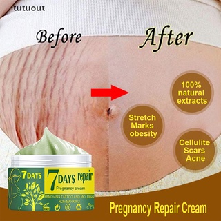 tutuout maternidad reparación de la piel suave crema de la piel para estrías cicatrices cuidado co (1)