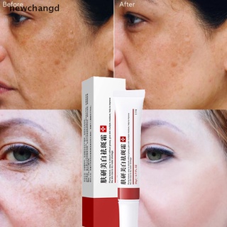 [nuevo] blanqueamiento pecas crema eliminar melasma acné punto pigmento melanina crema facial