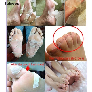 [efl] mujer máscara de pie calcetín peel eliminar piel muerta pies cuidado hidratado silicona calcetines gdx (7)