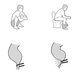 Bathroom Toilet Step Stools For The Elderly Pregnant Women And Children Stools (1)