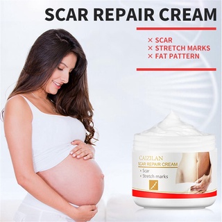【Chiron】Removal Acne Scar Stretch Marks Cream Fat Scar Striae Gravidarum Treatment