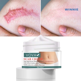 [winnie] 30 ml crema cicatrizante profundamente impregnada suavizar la cutícula cuidado de la piel acné estrías crema de eliminación para adultos