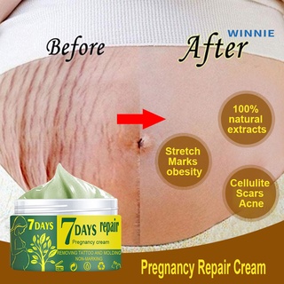 [winnie] crema de reparación de embarazo eliminación de estiramiento fácil de absorber extractos naturales de la piel de la cicatriz eliminar crema para la madre (1)