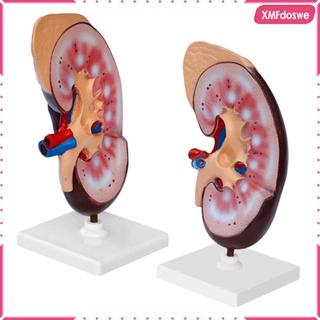 Human Kidney Anatomical Anatomy Kidney Model Teaching Aids Kidney Structure
