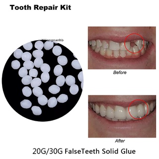 yijiangnanhb temporal kit de reparación de dientes dientes y huecos falseteeth pegamento sólido dentadura adhesivo caliente