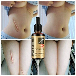 Massage oils Scar Removal Lavender Oil For Pregnant Women Hyaluronic Acid Serum