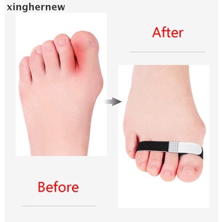 [xinghernew] 2 piezas corrector de dedos del dedo del pie hallux valgus corrector del dedo del pie vendaje separador envoltura caliente (6)