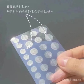 Acne Patch Acne Cover Patch Anti-Acne Anti-Inflammatory Makeup Invisible Acnecare Removing Acne Strong Acne Student Mask