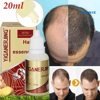 [winnie] esencia unisex de crecimiento del cabello anti pérdida tratamiento del cuero cabelludo control de aceite cuidado de la salud