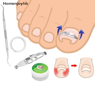 hhb> dedo encarnado dedo del pie recuperar corrección parche pedicura uñas fijador cuidado de pies herramienta bien