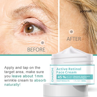 PF_30ml Crema Facial Retinol Activa No Irritante Antienvejecimiento Extracto Natural Anti Arrugas Mejora Líneas Finas De Para Mujer (3)