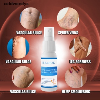 [coldwendys] 1pc venas varicosas spray vasculitis phlebitis pierna araña tratamiento crema