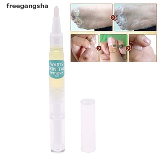 [freegangsha] removedor de la piel/cara removedor de verrugas genital tratamiento eliminación mole y papillomas pie maíz dgdz