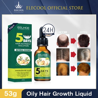eelhoe 30ml ginger hair care essential oil hair growth INHERITANCE