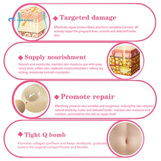 stock 30ml estrías aceite esencial piel cuidado del cuerpo embarazo postparto reparación (8)