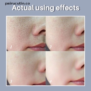 (nuevo) suero retráctil de poros ácido hidratante reparación de poros faciales tratamiento esencia líquido [pairucutin] (1)