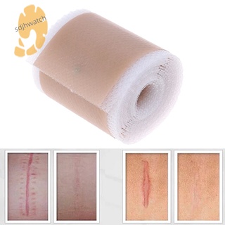 Efficient Beauty Scar Removal Silicone Gel Self-Adhesive Silicone Gel Tape Patch for Acne Burn Scar Reduce (1)