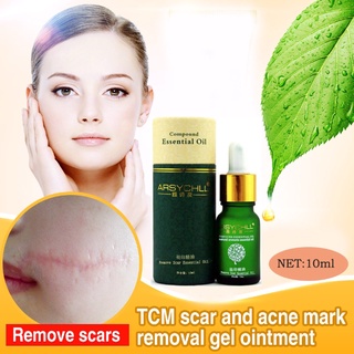 ❥ 2020- Hot Sale Face Care Acne Scar Removal Cream Acne Spots Skin Care Treatment Stretch Marks (1)