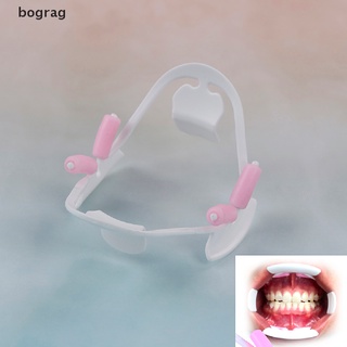 [bograg] abrelatas bucales 3d oral para mejillas intraorales retráctil de labios prop ortodoncia adulto 579co