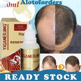 alotoforders11.co Unisex Hair Growth Essence Anti Loss Scalp Treatment Oil Control Health Care