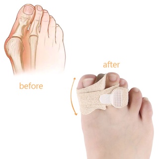 [bsb] 1 par/2pcs hallux vbsbus separador orthats toes corrector ajustador cuidado de los pies [baishangbest] (7)