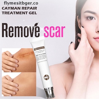 flyger 20g crema de eliminación de cicatrices de acné espinillas estrías cara eliminar acné suavizante.