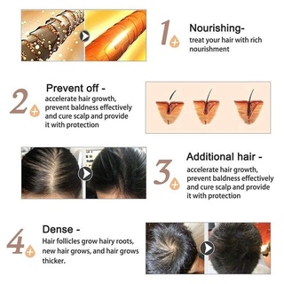 Anti Hair Loss Treatments Regrowth Natural Extract Oil Products for Men Women (4)