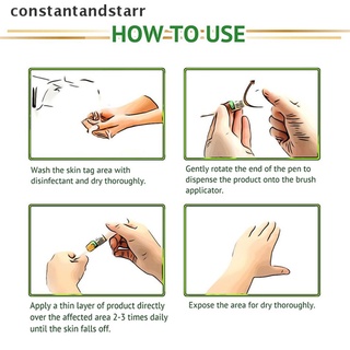 [constantandstarr] removedor de etiquetas de piel contra topo y verrugas genitales eliminación rápida anti pie de maíz dsgs