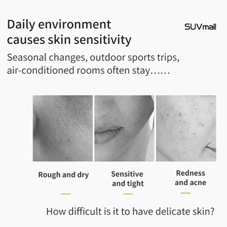 Suv-Crema Calmante De 30g Para cuidado De la piel sin arrugas/crema Calmante Para niñas (7)