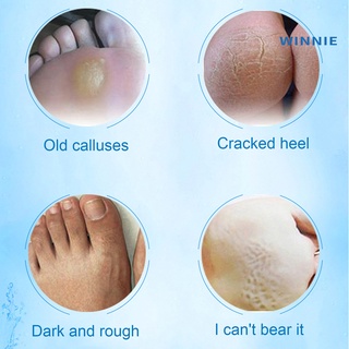 [winnie] 2 fundas de pie efero para eliminación de la piel muerta hidratante exfoliante cuidado de los pies (4)