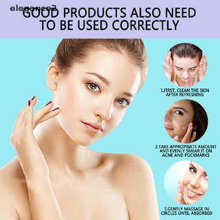 [elegance2] pro.w crema de manchas anti acné cicatrices manchas oscuras eliminación de la piel blanqueamiento 30 ml [elegance2]