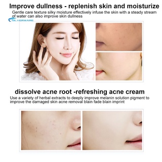 stock 3pcs acné comedo eliminación de poros retráctiles control de aceite hidratante cuidado de la piel crema (6)