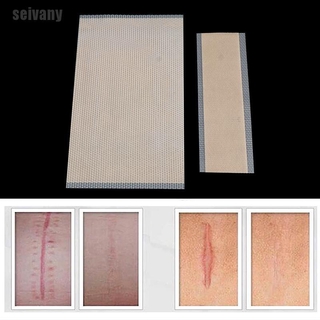 [sei] parche de silicona eficiente para reparación de cicatrices baa