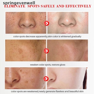 Evenwell Effective Whitening Freckle Cream Remove Pigmentation Moisturizing Gel Skin Care New Stock