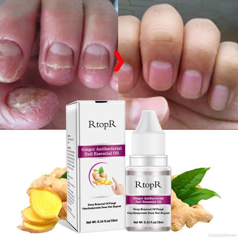 rtopr aceite esencial antibacteriano para uñas de jengibre tratamiento antifúngico