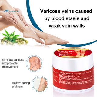 stock 10g venas crema fácil de absorber reparación hinchazón mejorar metabolismo varicosa vasculitis phlebitis crema de araña yeso para adultos (1)
