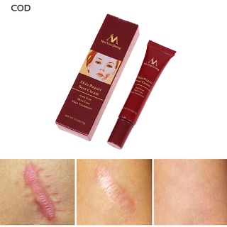 [cod] removedor de cicatrices crema para el cuidado de la piel cirugía de cicatrices cortes de acné quemaduras manchas de estrías caliente