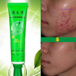 SF Effective Removal Acne Cream Spots Scar Stretch Marks Treatment Cream Skin Care (1)