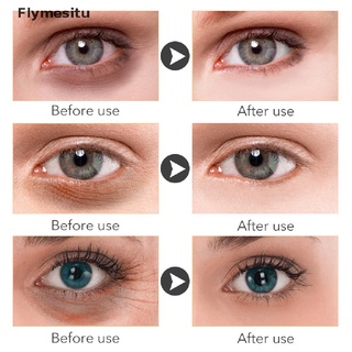 [flymesitu] retinol crema facial crema de ojos levantamiento anti envejecimiento bolsas anti ojos eliminar arrugas.