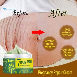 stock crema de reparación de embarazo eliminación de estiramiento fácil de absorber extractos naturales de la piel de la cicatriz eliminar crema para la madre (1)