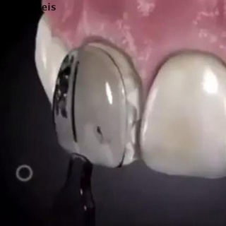 [kacomeis] 30 moldes dentales de resina compuesta cura de luz anterior dientes delanteros rápidos gyjx