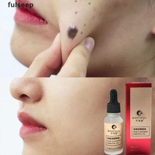 [fulseep] crema reparadora de nevus para eliminación natural/suero purificador de manchas de piel orgánica sdgc