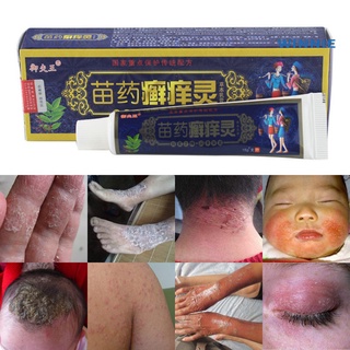 [winnie] bacteriostasis herbal ungüento antipruritico dermatitis eczema tratamiento